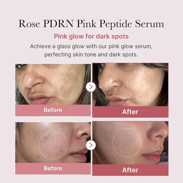 Medicube PDRN Pink Peptide Serum – Revitalize & Glow 30 ML - Image 2