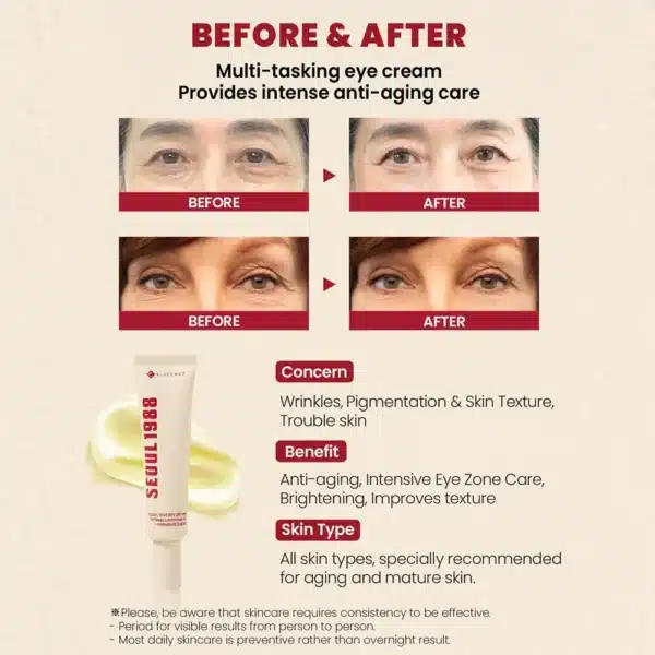 KSECRET SEOUL 1988 Eye Cream : Retinal Liposome 4% + Fermented Bean 30ml - Image 3